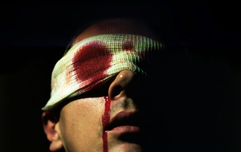 En man med blodig ögonbindel som hänger över hans ögon.