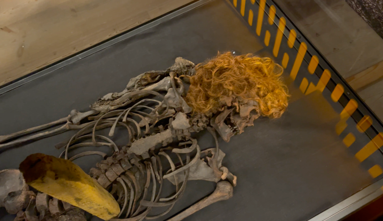 Skelett med guldfärgat hår som ligger på en metallplatta.